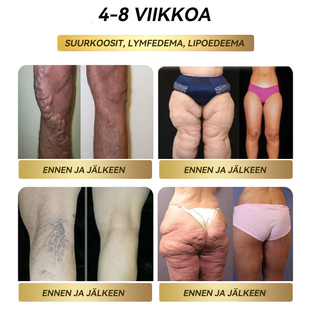 ✅𝐓𝐮𝐫𝐮𝐧 𝐲𝐥𝐢𝐨𝐩𝐢𝐬𝐭𝐨𝐧 𝐥ää𝐤𝐞𝐭𝐢𝐞𝐭𝐞𝐞𝐥𝐥𝐢𝐬𝐞𝐧 𝐭𝐢𝐞𝐝𝐞𝐤𝐮𝐧𝐧𝐚𝐧 𝐤𝐞𝐡𝐢𝐭𝐭ä𝐦ä | 𝑭𝑨𝑻𝑶𝑵𝑮® 𝑮𝑳𝑷-1 𝑺𝒖𝒖𝒏 𝒌𝒂𝒖𝒕𝒕𝒂 𝒐𝒕𝒆𝒕𝒕𝒂𝒗𝒂 𝒏𝒆𝒔𝒕𝒆 𝑻ä𝒚𝒅𝒆𝒏𝒏𝒚𝒔(Liikalihavuus, sydän- ja verisuonisairaudet, diabetes, uniapnea, nivelongelmat ja paljon muuta)
