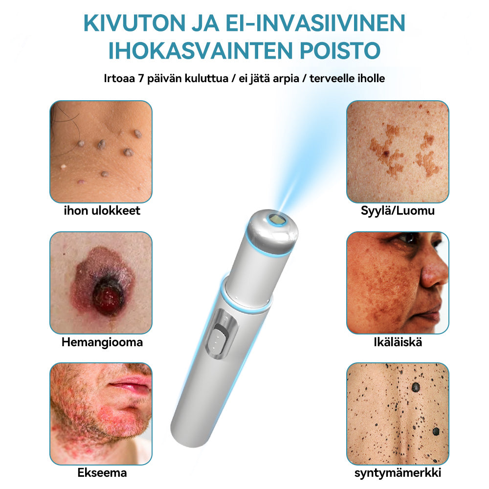 𝐉𝐚𝐬𝐬𝐞𝐞𝐦® lääkinnällisen tason laserpeni 🏆 (käyttää hiilidioksidilasertekniikkaa – poistaa tehokkaasti luomet, syylät, ihotagit, pigmenttiläiskät ja muut ihon virheet)
