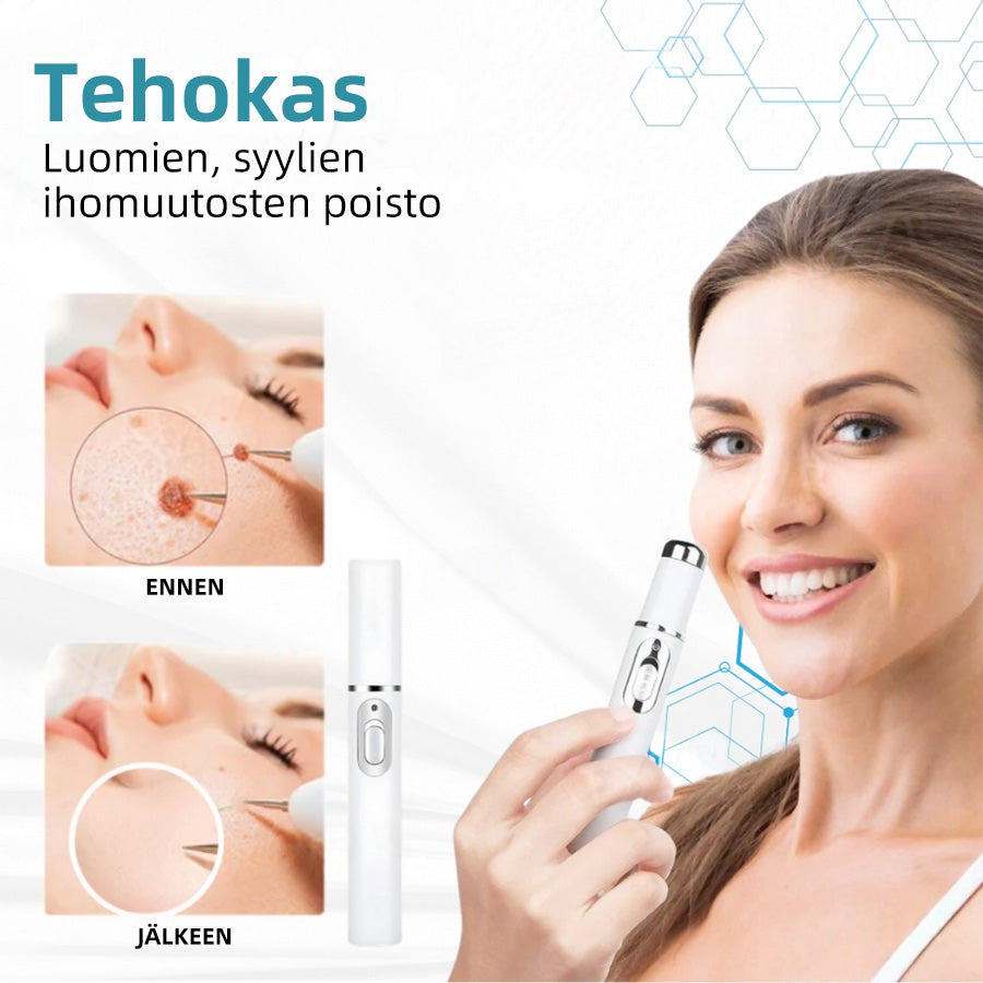 𝐉𝐚𝐬𝐬𝐞𝐞𝐦® lääkinnällisen tason laserpeni 🏆 (käyttää hiilidioksidilasertekniikkaa – poistaa tehokkaasti luomet, syylät, ihotagit, pigmenttiläiskät ja muut ihon virheet)